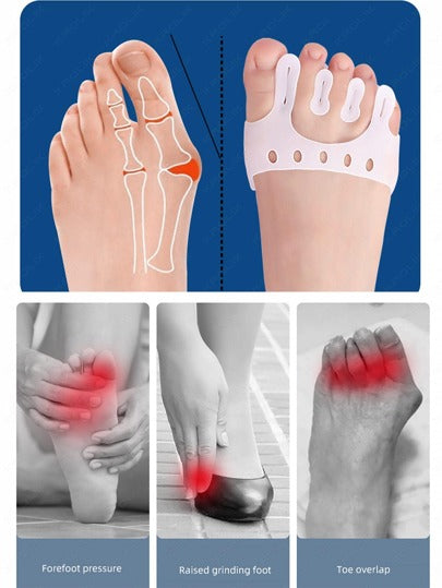 Toe Separator for Overlapping Toes